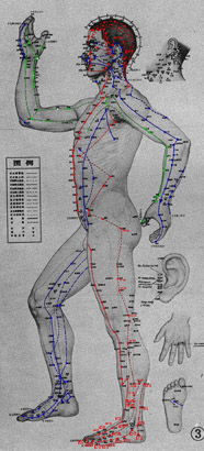Acupuncture: définition.