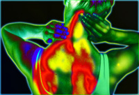 La Fibromyalgie par le Dr Philippe Tournesac