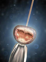 Actualité fibro - spasmo.