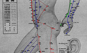 Acupuncture: définition.