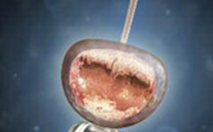 Actualité fibro - spasmo.