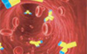 Le Syndrome de Fatigue Chronique est-il une maladie auto-immune ?