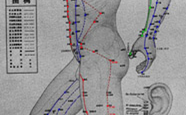 Acupuncture: définition.