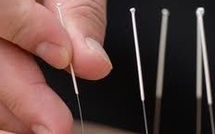 MTC et Médecines intégratives à l'hôpital : cas de la médecine traditionnelle chinoise
