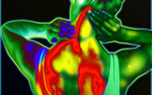 La Fibromyalgie par le Dr Philippe Tournesac